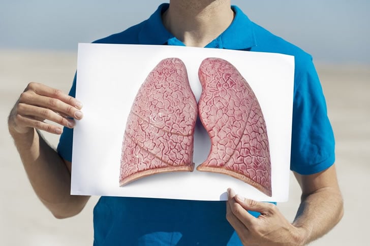 How to Navigate the Treatment Options for Lung Cancer